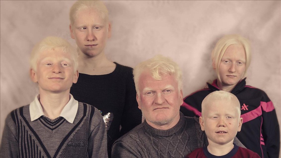 Türkiye’nin beyaz melekleri "Albinolar" 1