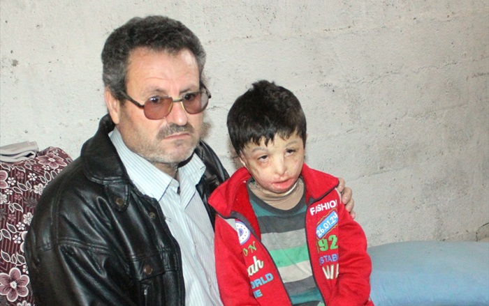 Suriyeli Mahmud'u varil bombası yaktı 