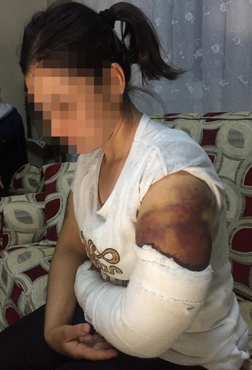 Eşini demir çubukla darbettiği iddiası