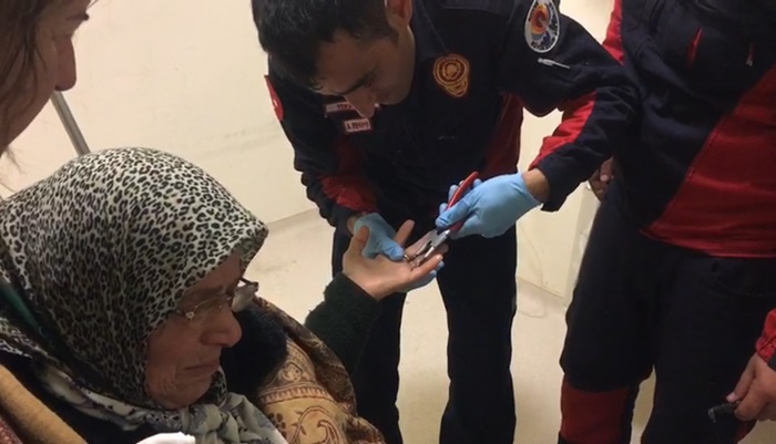 İtfaiyeden yüzük çıkartma operasyonu