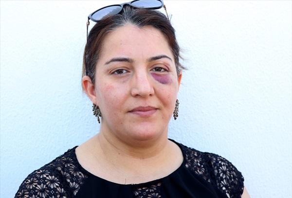 'Eşim ile birlikte sopayla çocuğumuzun gözü önünde darbedildik..'